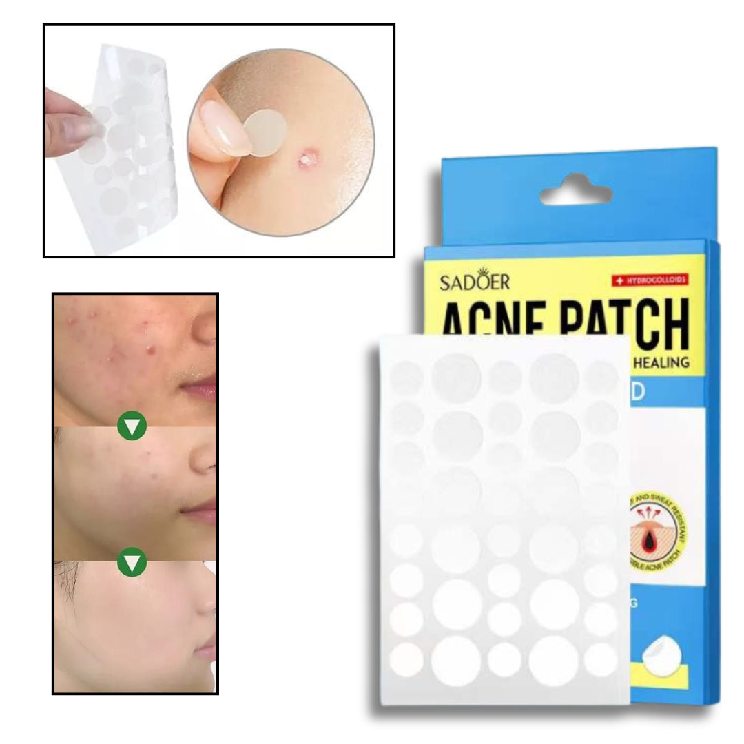 Parches Adhesivos Invisibles Anti Acne Con Acido Salicilico x 36 SD09630